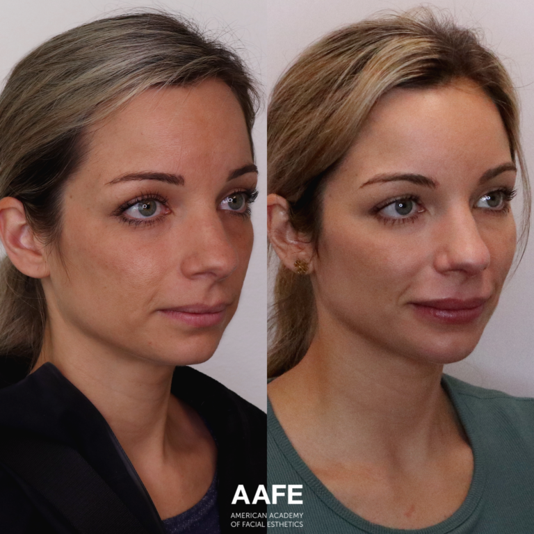 Full Face