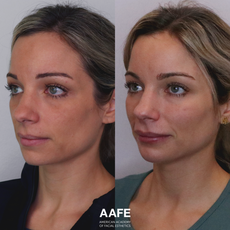 Full Face