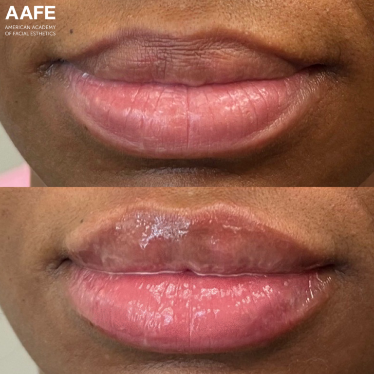 Lip Borders - Smooth Threads