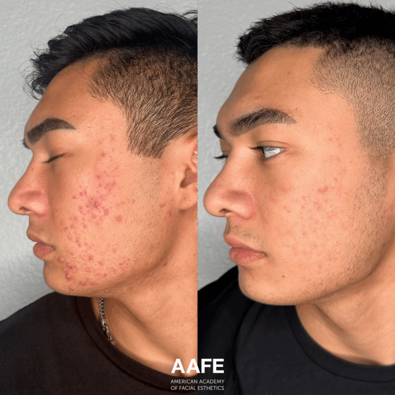 Skincare 1