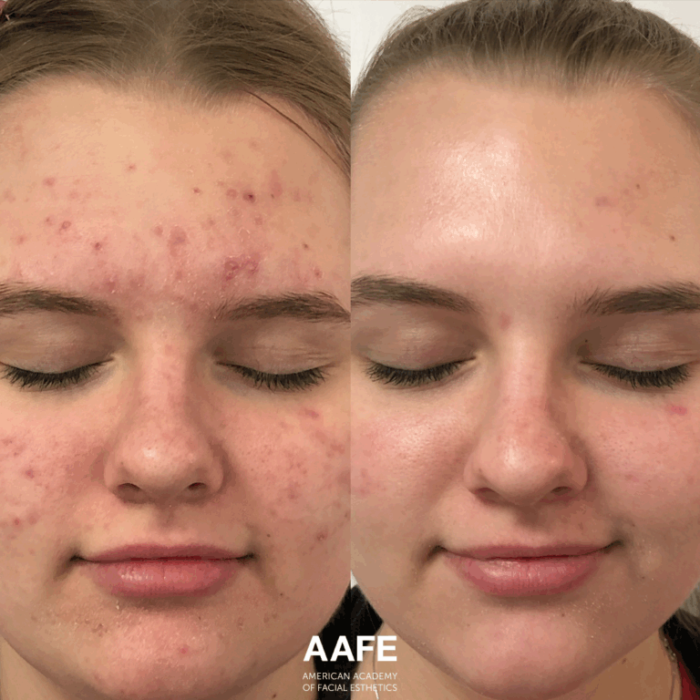 Skincare 2