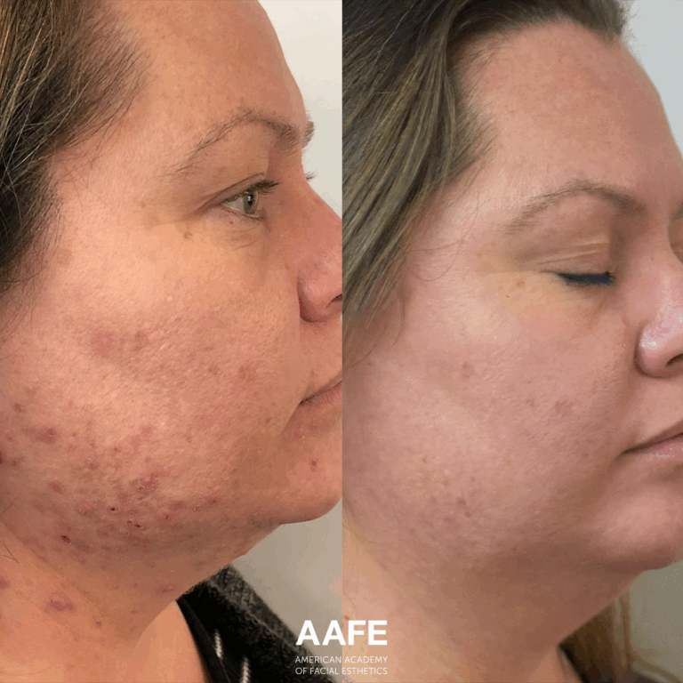 Skincare 4